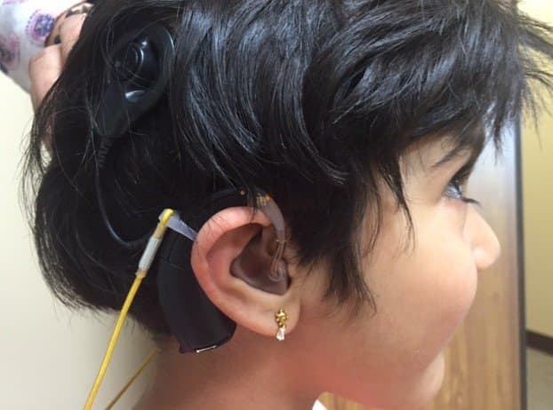 New Technology Brings Sound To Little Girl