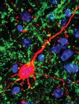A short stay in darkness may heal hearing woes — ScienceDaily